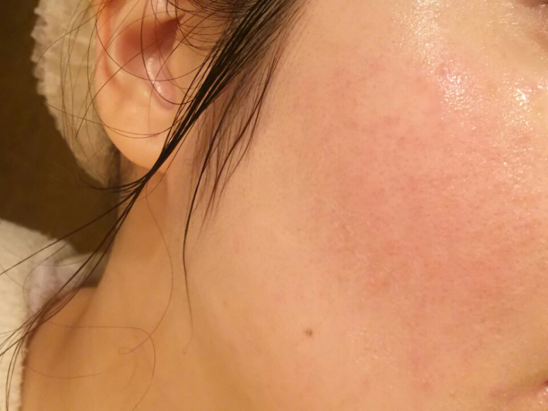 レポート詳細 Drメディアッククリスタル シミ ソバカス 美白化粧品 オッペン化粧品 Oppen Cosmetics レポート詳細 Drメディアッククリスタル シミ ソバカス 美白化粧品 オッペン化粧品 Oppen Cosmetics
