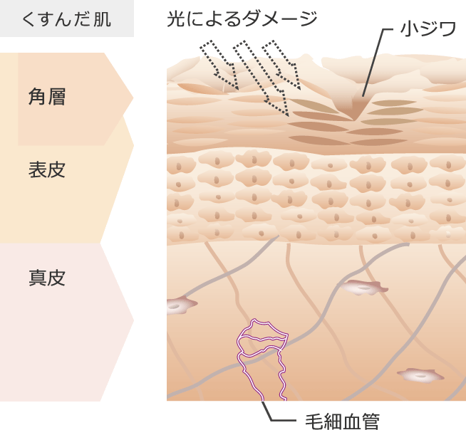 くすんだ肌