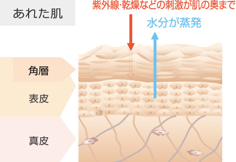 あれた肌