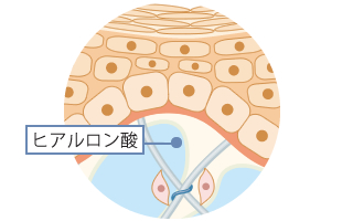 ヒアルロン酸